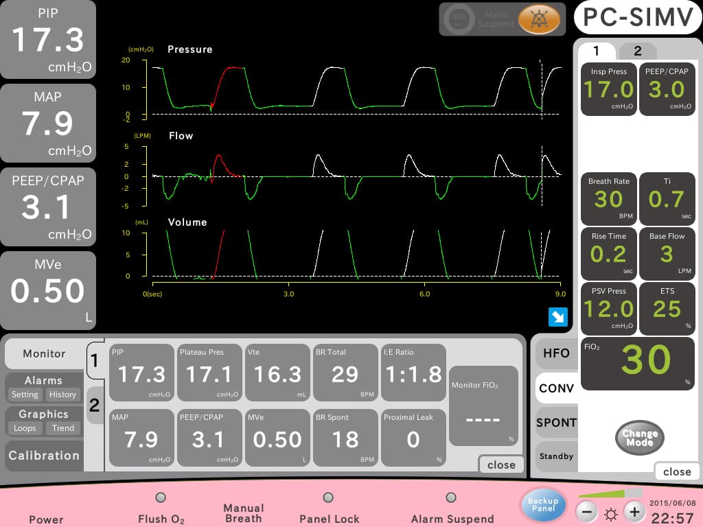 Humming Vue - Pressure Control
